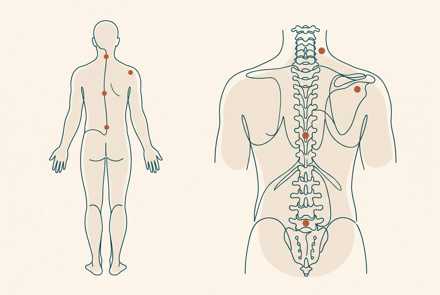 Line drawing of the human body and spine with the common pain areas — neck, shoulder, mid and lower back — gently marked